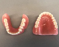 Complete dentures